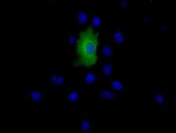 EPHX2 Monoclonal Antibody (OTI2G2), TrueMAB , OriGene 100 &mu;L; Unconjugated:Antibodies,