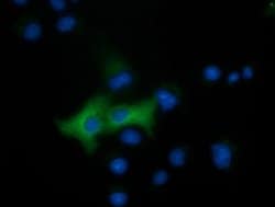 EPHX2 Monoclonal Antibody (OTI3F6), TrueMAB , OriGene 30 &mu;L; Unconjugated:Antibodies,