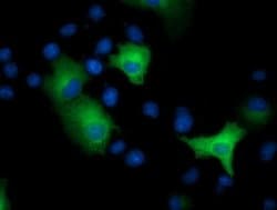 EPHX2 Monoclonal Antibody (OTI2F2), TrueMAB , OriGene 100 &mu;L; Unconjugated:Antibodies,