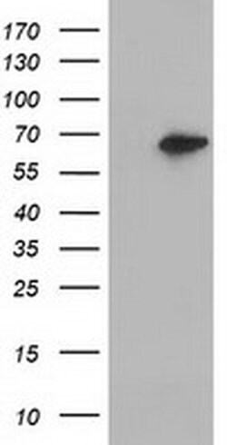 EPHX2 Monoclonal Antibody (OTI2F2), TrueMAB , OriGene 100 &mu;L; Unconjugated:Antibodies,