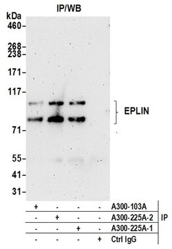EPLIN Rabbit anti-Human, Polyclonal, Bethyl Laboratories 100 &mu;L; Unconjugated:Antibodies,