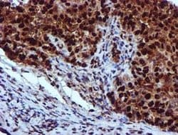 EPM2AIP1 Monoclonal Antibody (OTI2A2), TrueMAB , OriGene 100 &mu;L; Unconjugated:Antibodies,