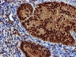 EPM2AIP1 Monoclonal Antibody (OTI2A2), TrueMAB , OriGene 100 &mu;L; Unconjugated:Antibodies,