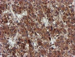 EPM2AIP1 Monoclonal Antibody (OTI2A2), TrueMAB , OriGene 100 &mu;L; Unconjugated:Antibodies,