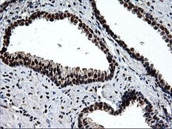 EPM2AIP1 Monoclonal Antibody (OTI1G9), TrueMAB , OriGene 100 &mu;L; Unconjugated:Antibodies,
