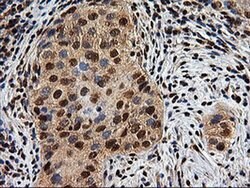 EPM2AIP1 Monoclonal Antibody (OTI1G9), TrueMAB , OriGene 100 &mu;L; Unconjugated:Antibodies,