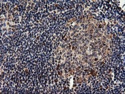 EPM2AIP1 Monoclonal Antibody (OTI1G9), TrueMAB , OriGene 100 &mu;L; Unconjugated:Antibodies,