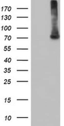 EPM2AIP1 Monoclonal Antibody (OTI2A2), TrueMAB , OriGene 100 &mu;L; Unconjugated:Antibodies,