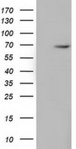 EPM2AIP1 Monoclonal Antibody (OTI5G8), TrueMAB , OriGene 30 &mu;L | Buy Online | Origene Technologies | Fisher Scientific