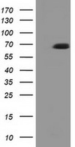 EPM2AIP1 Monoclonal Antibody (OTI1D11), TrueMAB , OriGene 100 &mu;L; Unconjugated:Antibodies,