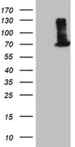 EPM2AIP1 Monoclonal Antibody (OTI1G9), TrueMAB , OriGene 100 &mu;L; Unconjugated:Antibodies,