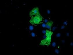 EPN2 Monoclonal Antibody (OTI1H3), TrueMAB , OriGene 100 &mu;L; Unconjugated:Antibodies,