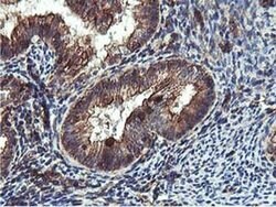 EPN2 Monoclonal Antibody (OTI1H3), TrueMAB , OriGene 100 &mu;L; Unconjugated:Antibodies,