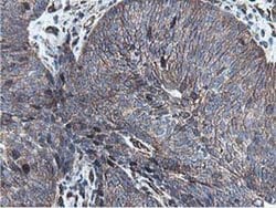 EPN2 Monoclonal Antibody (OTI1H3), TrueMAB , OriGene 100 &mu;L; Unconjugated:Antibodies,
