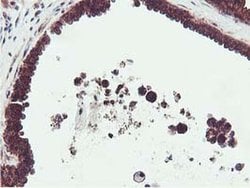 EPN2 Monoclonal Antibody (OTI1G3), TrueMAB , OriGene 100 &mu;L; Unconjugated:Antibodies,