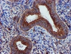 EPN2 Monoclonal Antibody (OTI1F1), TrueMAB , OriGene 30 &mu;L; Unconjugated:Antibodies,