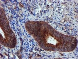 EPN2 Monoclonal Antibody (OTI1B4), TrueMAB , OriGene 100 &mu;L; Unconjugated:Antibodies,