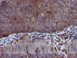 EPN2 Monoclonal Antibody (OTI1B4), TrueMAB , OriGene 100 &mu;L; Unconjugated:Antibodies,