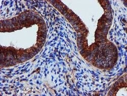 EPN2 Monoclonal Antibody (OTI1C5), TrueMAB , OriGene 30 &mu;L; Unconjugated:Antibodies,