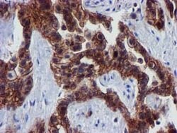 EPN2 Mouse anti-Human, Clone: OTI1F5, lyophilized, TrueMAB 100 &mu;g | Buy Online | OriGene | Fisher Scientific