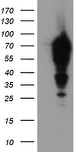EPN2 Monoclonal Antibody (OTI1H3), TrueMAB , OriGene 100 &mu;L; Unconjugated:Antibodies,