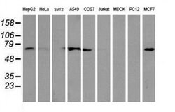 EPN2 Monoclonal Antibody (OTI1H3), TrueMAB , OriGene 100 &mu;L; Unconjugated:Antibodies,