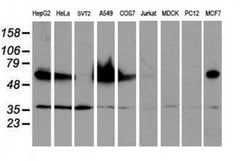 EPN2 Monoclonal Antibody (OTI1G3), TrueMAB , OriGene 100 &mu;L; Unconjugated:Antibodies,
