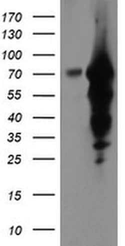 EPN2 Monoclonal Antibody (OTI1F1), TrueMAB , OriGene 30 &mu;L; Unconjugated:Antibodies,