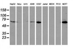 EPN2 Monoclonal Antibody (OTI1F1), TrueMAB , OriGene 30 &mu;L; Unconjugated:Antibodies,