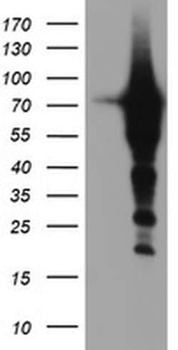 EPN2 Monoclonal Antibody (OTI1B4), TrueMAB , OriGene 100 &mu;L; Unconjugated:Antibodies,