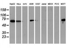 EPN2 Monoclonal Antibody (OTI1B4), TrueMAB , OriGene 100 &mu;L; Unconjugated:Antibodies,