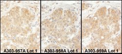 EPRS Rabbit anti-Human, Mouse, Polyclonal, Bethyl Laboratories 100 &mu;L;