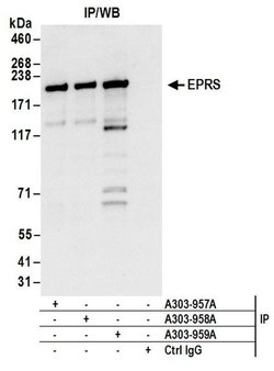 EPRS Rabbit anti-Human, Mouse, Polyclonal, Bethyl Laboratories 100 &mu;L;