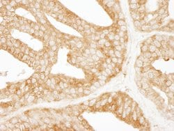 EPS15 Rabbit anti-Human, Polyclonal, Bethyl Laboratories 100 &mu;L; Unconjugated:Antibodies,