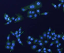 HER2/ErbB2 Polyclonal Antibody, Huabio 100 &mu;L; Unconjugated:Antibodies,