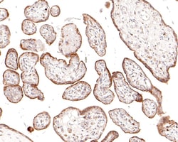 HER2/ErbB2 Polyclonal Antibody, Huabio 100 &mu;L; Unconjugated:Antibodies,