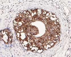 HER2/ErbB2 Polyclonal Antibody, Huabio 100 &mu;L; Unconjugated:Antibodies,