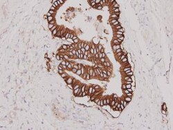 HER2/ErbB2 Polyclonal Antibody, Huabio 100 &mu;L; Unconjugated:Antibodies,