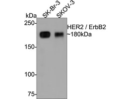 HER2/ErbB2 Polyclonal Antibody, Huabio 100 &mu;L; Unconjugated:Antibodies,