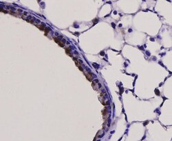 TLR7 Polyclonal Antibody, Huabio 100 &mu;L; Unconjugated:Antibodies, Polyclonal