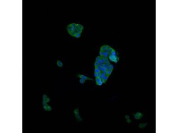 CD31 Polyclonal Antibody, Huabio 100 &mu;L; Unconjugated:Antibodies, Polyclonal