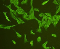 CD31 Polyclonal Antibody, Huabio 100 &mu;L; Unconjugated:Antibodies, Polyclonal
