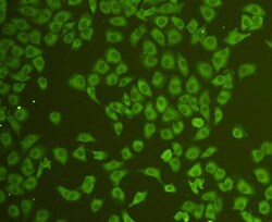 CD31 Polyclonal Antibody, Huabio 100 &mu;L; Unconjugated:Antibodies, Polyclonal