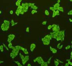 CD31 Polyclonal Antibody, Huabio 100 &mu;L; Unconjugated:Antibodies, Polyclonal
