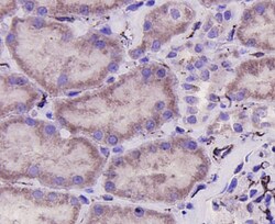 CD31 Polyclonal Antibody, Huabio 100 &mu;L; Unconjugated:Antibodies, Polyclonal
