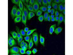 GRP78 Polyclonal Antibody, Huabio 100 &mu;L; Unconjugated:Antibodies, Polyclonal