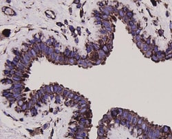GRP78 Polyclonal Antibody, Huabio 100 &mu;L; Unconjugated:Antibodies, Polyclonal