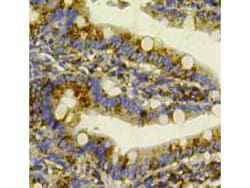 GRP78 Polyclonal Antibody, Huabio 100 &mu;L; Unconjugated:Antibodies, Polyclonal