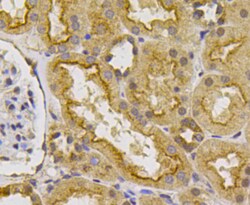 VEGFR1 Polyclonal Antibody, Huabio 100 &mu;L; Unconjugated:Antibodies,