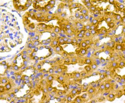 VEGFR1 Polyclonal Antibody, Huabio 100 &mu;L; Unconjugated:Antibodies,